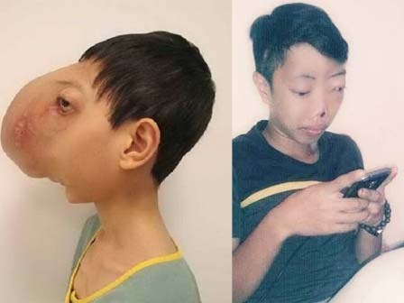 Thay đổi diệu kỳ của chàng trai Việt 