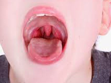 Miệng 'bốc mùi' là do căn bệnh nguy hiểm này