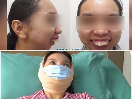Vì ngoại hình, cô gái thông thạo 3 thứ tiếng vẫn không xin được việc dù đã qua 45 lần phẫu thuật
