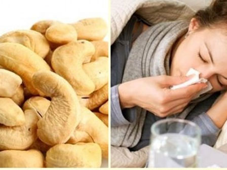 Người phụ nữ có gần trăm viên sỏi mật vì thường làm điều này buổi sáng-4