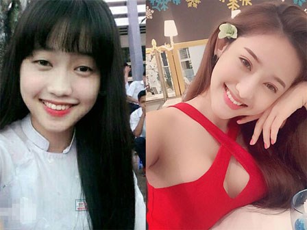 Nhìn lại hành trình tu sửa nhan sắc của