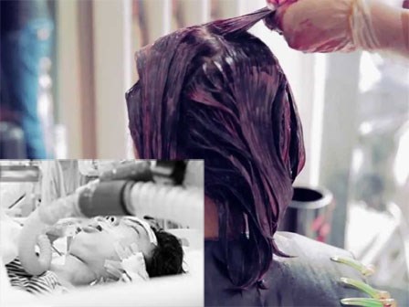 Báo động: Cô giáo 47 tuổi tử vong sau 10 ngày nhuộm tóc
