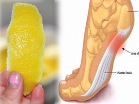 Dùng vỏ chanh theo cách này sẽ giúp bạn hết đau nhức xương khớp mà không cần phải uống thuốc