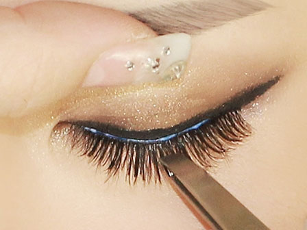 Nhiễm bọ ve trên mí mắt vì... nối mi-2