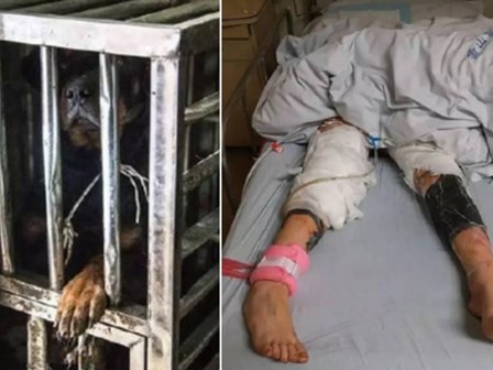 Giải thoát cho chó dữ, lại bị con vật này tấn công, cô bé 14 tuổi phải khâu 120 mũi