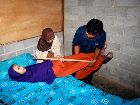 Căn bệnh lạ khiến cơ thể cô gái 