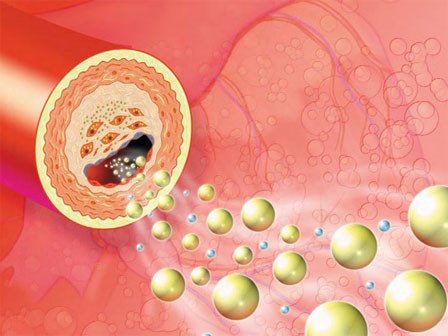 Nhà có người mắc 1 trong 5 bệnh sau, hãy cảnh giác vì chúng có khả năng di truyền