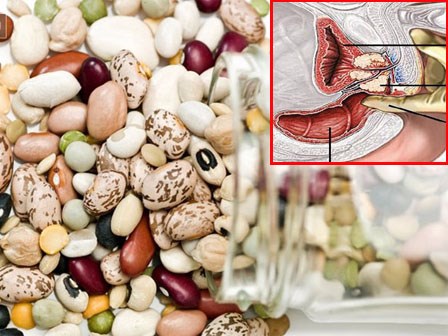 Căn bệnh này là nguyên nhân dẫn đến vô sinh: 7 lời chuyên gia khuyên để phòng bệnh