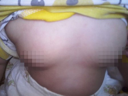 Bố mẹ phát hoảng khi con gái 5 tháng tuổi dậy thì như thiếu nữ vì món ăn hằng ngày