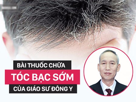 Tóc bạc sớm khiến bạn 