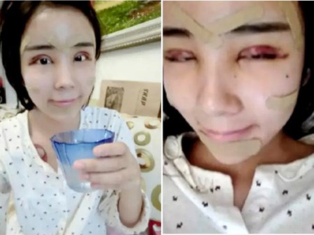 Mỹ nhân mặt rắn từng