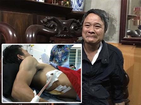 Kẻ dùng dao đâm người cứu nạn có hành vi