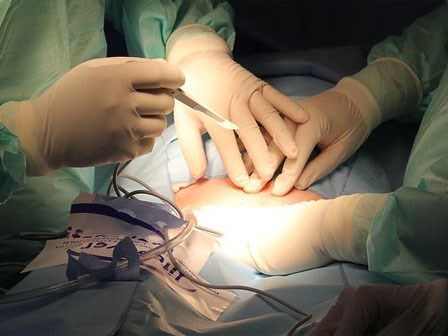 Mẹ nào sinh mổ đừng xem thường yêu cầu này của bác sĩ, chết như chơi