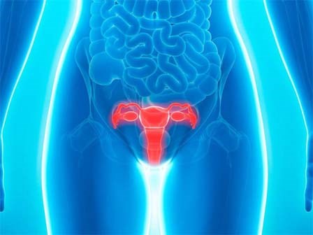 Căn bệnh gây ra những cơn đau kinh hoàng vùng xương chậu nhưng lại rất khó phát hiện