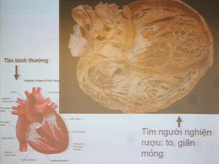 Hãy cho đấng mày râu xem hình ảnh dưới đây, dù đang say cũng phải đặt chén xuống ngay