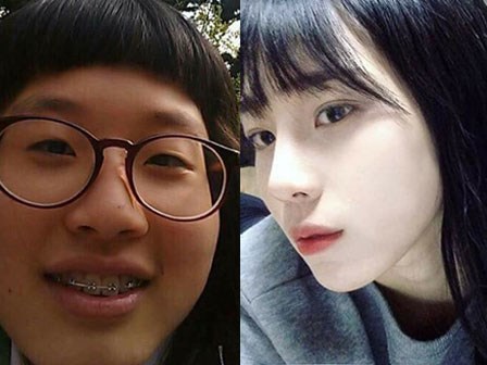 Bị đá vì ngoại hình 