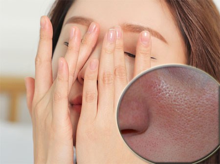 Kiên trì thực hiện các bước chăm sóc, lỗ chân lông có to mức nào cũng se khít nhanh chóng