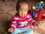 Hà Nội: Bé gái hơn 2 tháng tuổi tử vong chưa rõ nguyên nhân sau khi tiêm phòng-2
