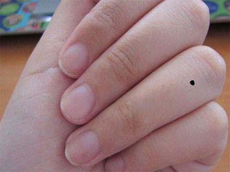 11 vị trí nốt ruồi ở tay nói lên điều gì?