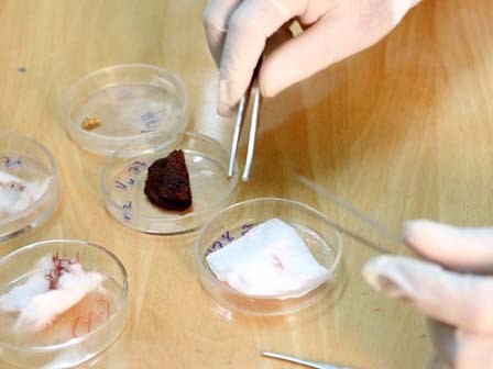 Bác sĩ pháp y: Nghề đối mặt với ám ảnh