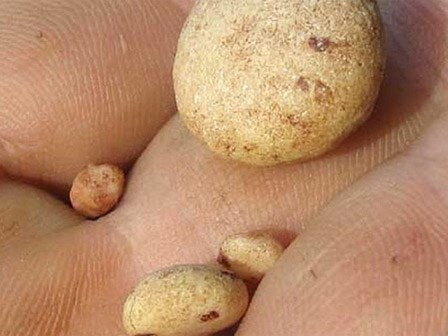 Bài thuốc uống trong 6 ngày là ra sỏi thận: Nhiều người