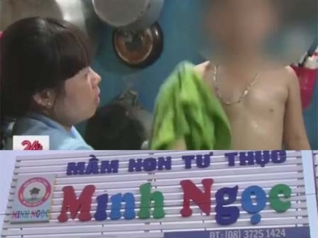 Cô giáo mầm non bị tố buộc dây thun vào dương vật khiến bé trai 4 tuổi phải nhập viện