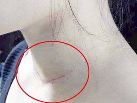 Cô gái trẻ bị chém vào cổ ngay trước cửa nhà