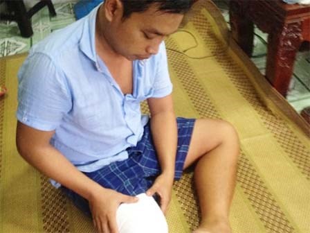 Vụ bệnh nhân bị cưa chân: Gia đình đề nghị khởi tố bác sĩ