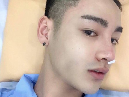 Chàng trai gây sốc khi công khai quá trình thẩm mỹ đau đớn,