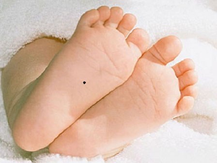 Dù là nam hay nữ cứ có 3 nốt ruồi ở vị trí này “tiền đè chết người”, cả đời không sợ “cháy túi”