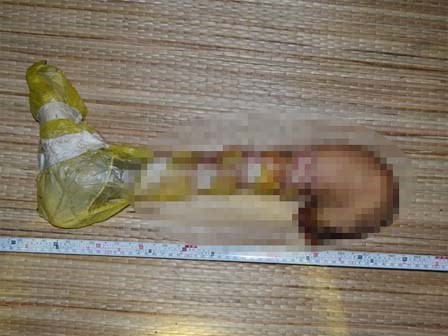 Phát hiện cẳng chân người trong túi nylon tại bãi rác lớn nhất Trà Vinh