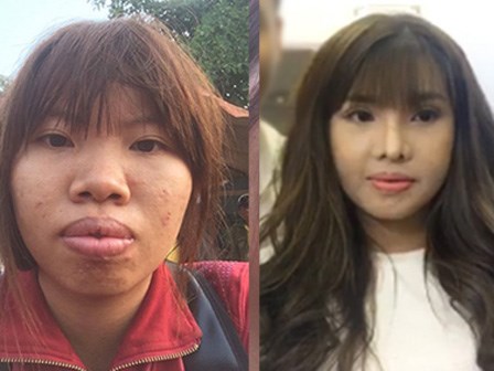 Cô gái Đăk Nông từng khốn khổ vì bị chê xấu nay đã lột xác ngoạn mục sau 1 tháng