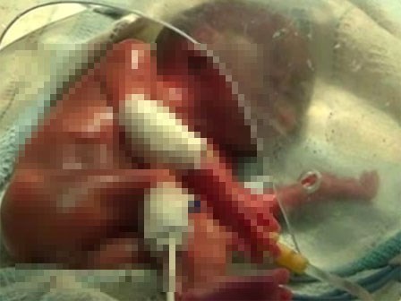 Bé sơ sinh “sống lại” sau khi bệnh viện xác nhận đã chết