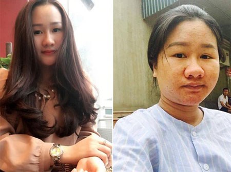 Khó nhận ra bà bầu từng trăn trở vì ngoại hình xấu xí cách đây hơn nửa năm