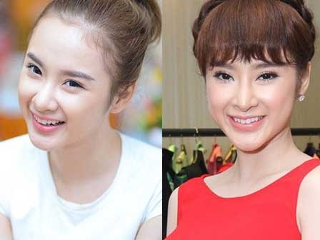 Angela Phương Trinh phải trải qua quá trình thẩm mỹ gian nan mới trở thành 
