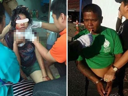 Bé gái 13 tuổi bị cha rạch cổ vì dành quá nhiều thời gian cho mạng xã hội