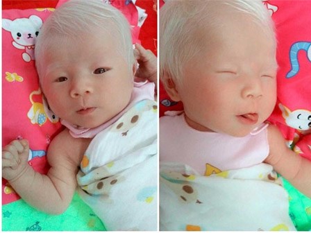 Sinh con da trắng như