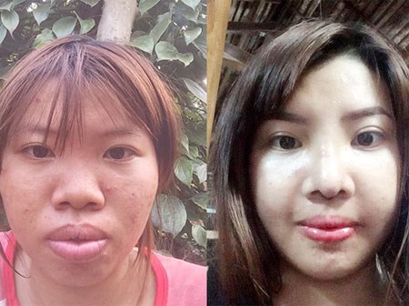 Sau phẫu thuật, cô gái 'Thị Nở' bị tố sống sang chảnh trong khi con gái ở quê nheo nhóc
