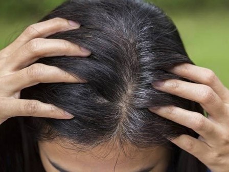 Đừng xem nhẹ, tóc bạc sớm cũng là dấu hiệu cảnh báo hàng loạt vấn đề sức khỏe