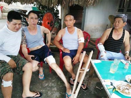 Côn đồ bịt mặt xông vào nhà truy sát 4 chú cháu ở Sài Gòn