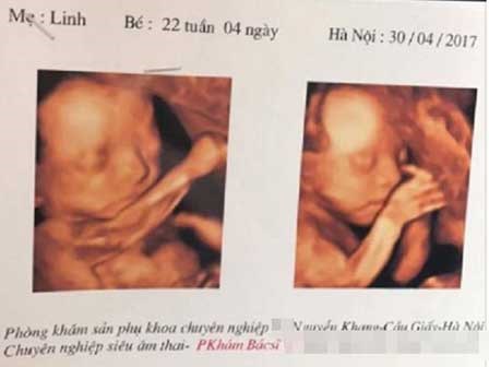 Tâm thư gửi bạn chồng: 'Nhờ các bạn mà vợ chồng tôi ly hôn' gây xôn xao cộng đồng mạng