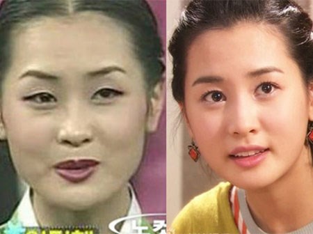 Những mỹ nhân châu Á từng kém sắc bỗng “đổi đời” nhờ phẫu thuật thẩm mỹ