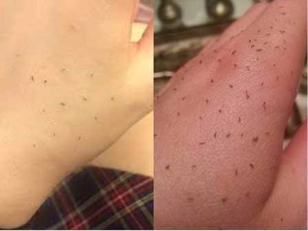 Thử ngay hôm nay: Cách hút nhờn