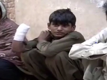 Chủ chặt tay bé trai 13 tuổi vì đòi lương và đồ ăn khiến dư luận phẫn nộ