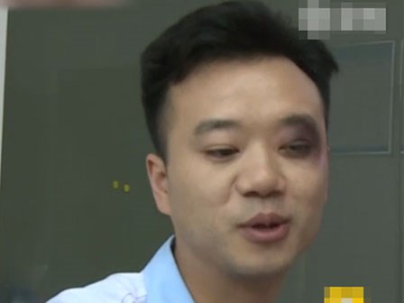 Vợ đánh chồng thâm mắt, nhưng sau đó phải xấu hổ xin lỗi khi biết nguyên nhân cao cả phía sau