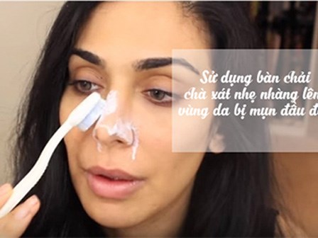 Trị sạch mụn đầu đen cứng đầu chỉ với 10 phút bôi kem đánh răng lên mũi