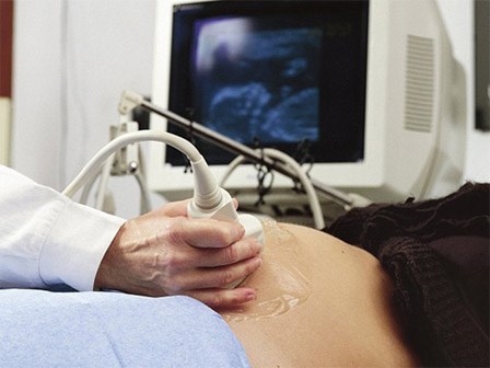 Cách đọc chỉ số siêu âm thai chuẩn xác nhất, mẹ bầu nào cũng cần biết