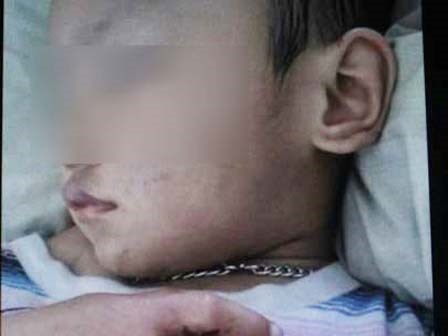 Nghi án bé trai 2 tuổi bị bạn trai của mẹ đánh đập