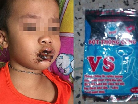 Cấp cứu bé 2 tuổi, bác sĩ BV Nhi cảnh báo sai lầm khi sơ cứu trẻ gặp nạn trong mùa hè