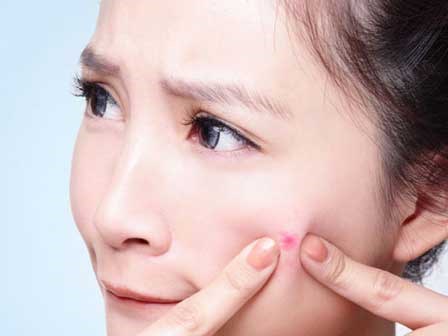 Chị em nặn mụn xong nhất định phải làm điều này để tránh nhiễm trùng và sẹo